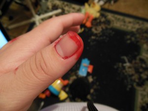 The Dangers of Making Blood